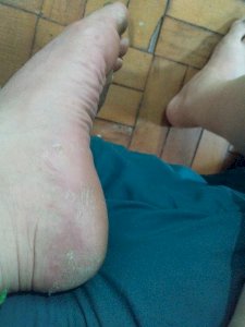 Quer um vídeo especial desse pezinho 